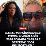 Cacau Protásio relata perda de visão após reação a pomada capilar