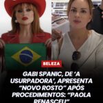Gaby Spanic surge com novo rosto após plásticas e web reage: “Paola renasceu”