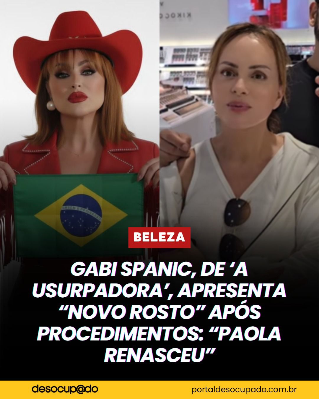 Gaby Spanic surge com novo rosto após plásticas e web reage: “Paola renasceu”