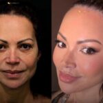 Solange Almeida exibe transformação no rosto e viraliza entre famosos