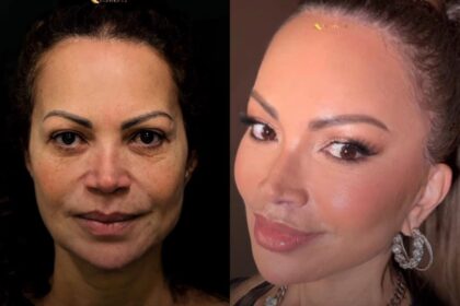 Solange Almeida exibe transformação no rosto e viraliza entre famosos