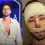 Rico Melquiades faz nova cirurgia plástica e some das redes sociais