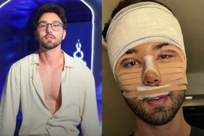 Rico Melquiades faz nova cirurgia plástica e some das redes sociais