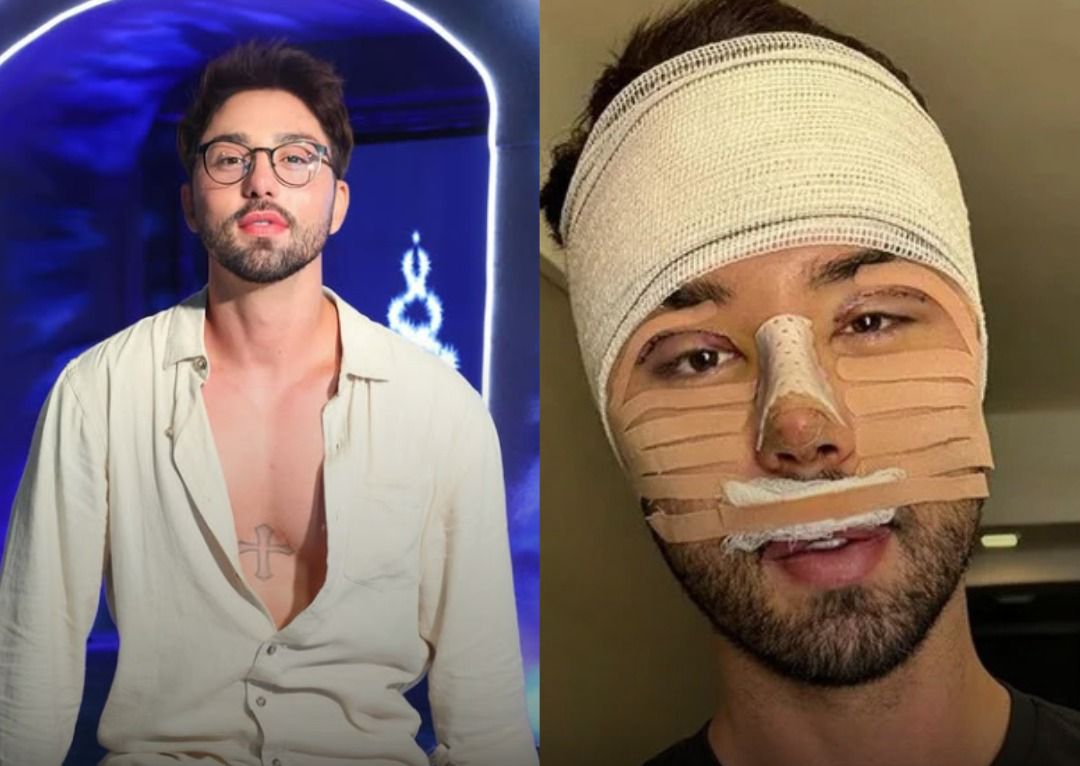 Rico Melquiades faz nova cirurgia plástica e some das redes sociais