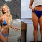 Yasmin Brunet revela perda de 25 kg e impressiona com antes e depois após tratar lipedema
