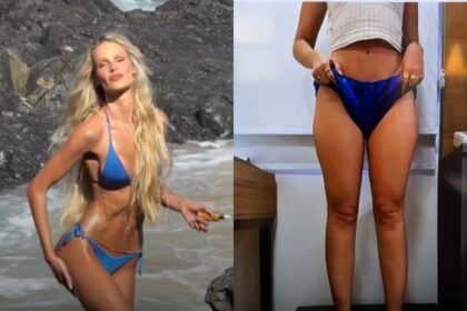 Yasmin Brunet revela perda de 25 kg e impressiona com antes e depois após tratar lipedema