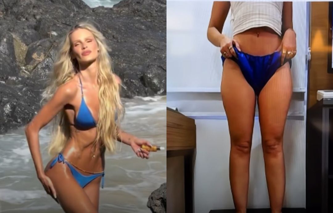 Yasmin Brunet revela perda de 25 kg e impressiona com antes e depois após tratar lipedema